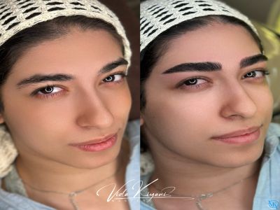 بهترین زمان شستشوی ابرو بعد از فیبروز