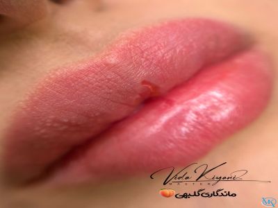 ماندگاری آرایش دائمی چقدر است؟