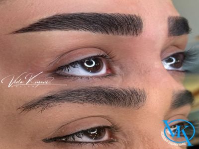 چرا بعضی ابرو های فیبروز شده پرتر به نظر می رسند؟