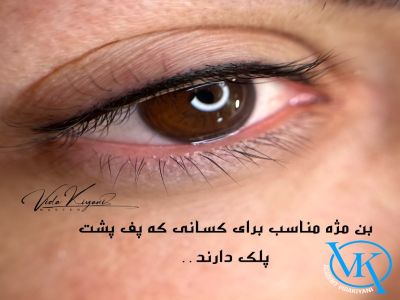 ماندگاری بن مژه