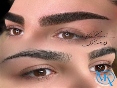 علت پخش شدن رنگ میکروبلیدینگ ابرو و راهکار آن