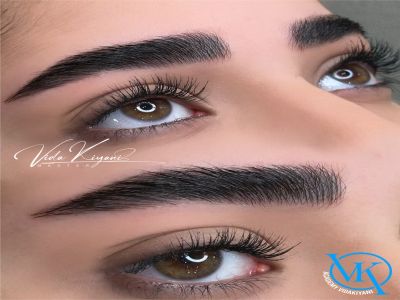 علت قرینه نشدن ابروها بعد از فیبروز چیست؟