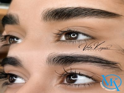 کاشت ابرو بهتر است یا میکروبلیدینگ