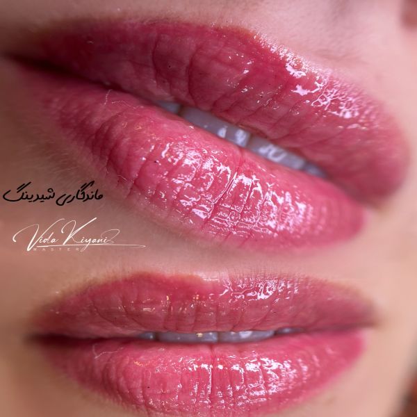 شیدینگ لب برای چه کسانی مناسب است؟