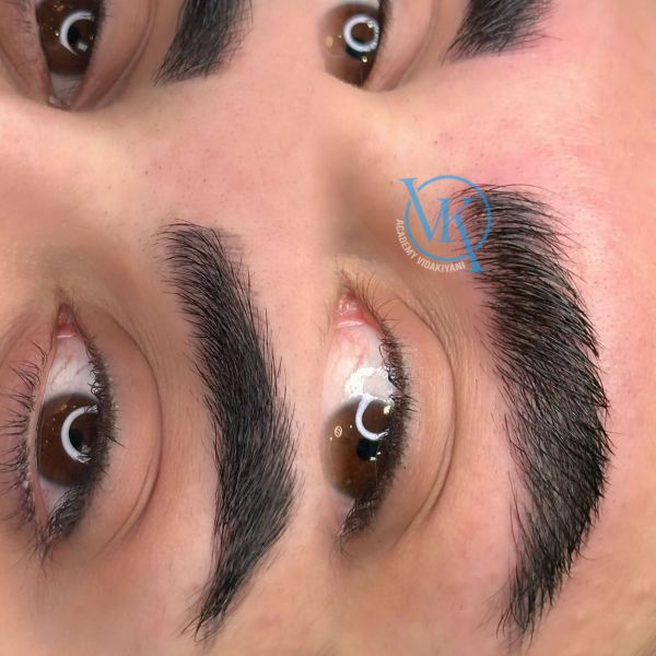 فیبروز ابرو