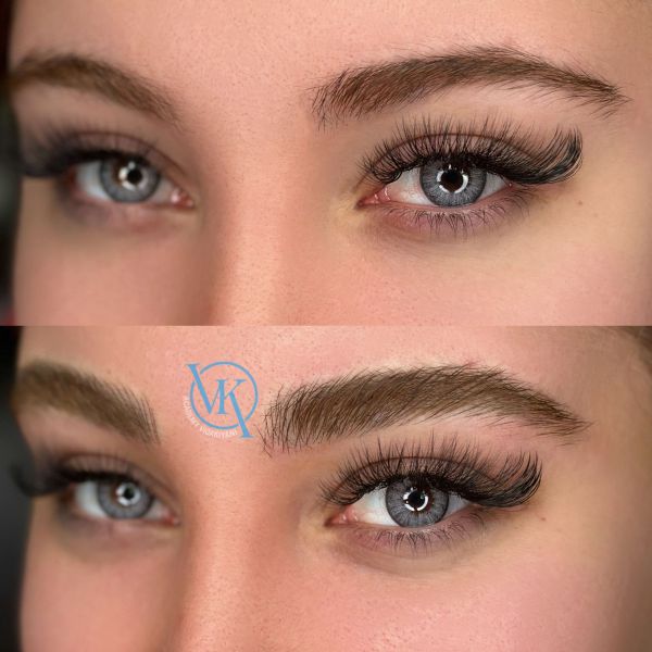 فیبروز ابرو