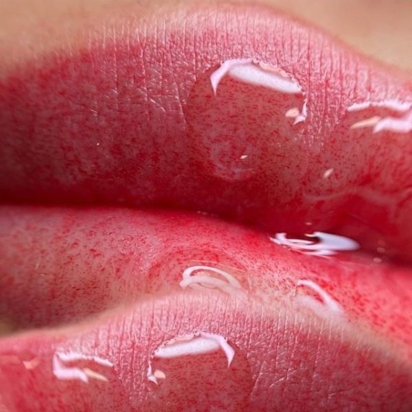 شیدینگ لب برای چه کسانی مناسب است؟