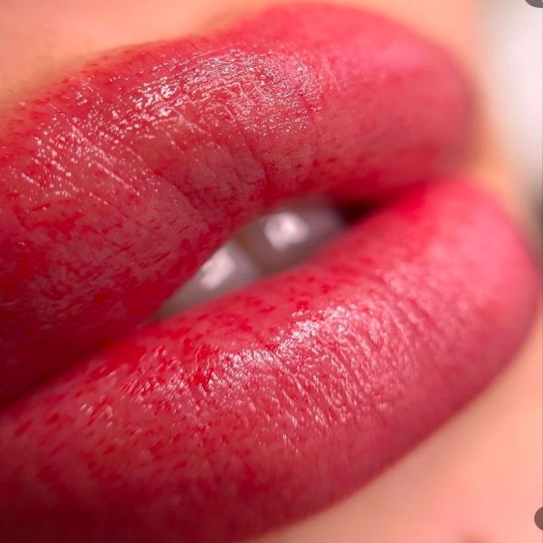 علت کبودی لب بعد از شیدینگ