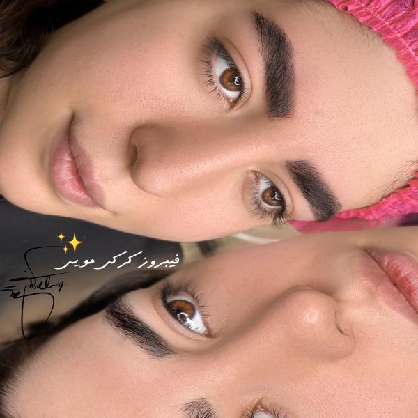 فیبروز ابرو