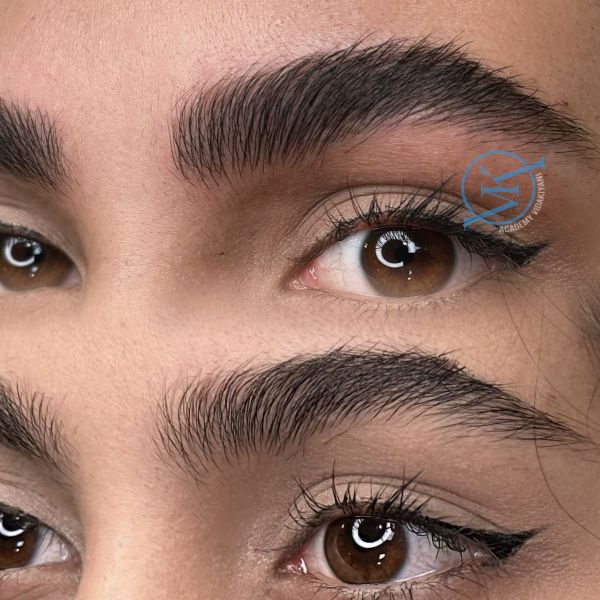 فیبروز ابرو