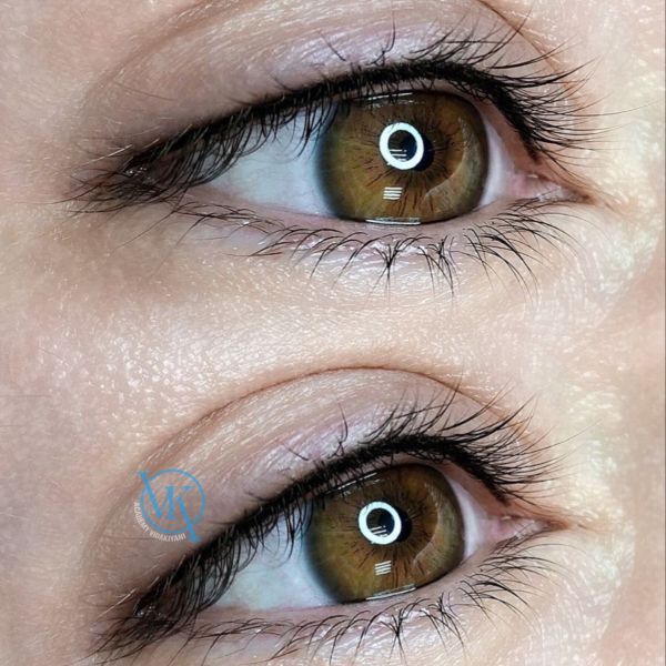 بن مژه طبیعی