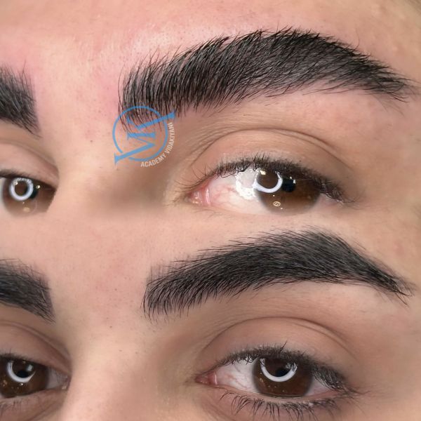 فیبروز ابرو