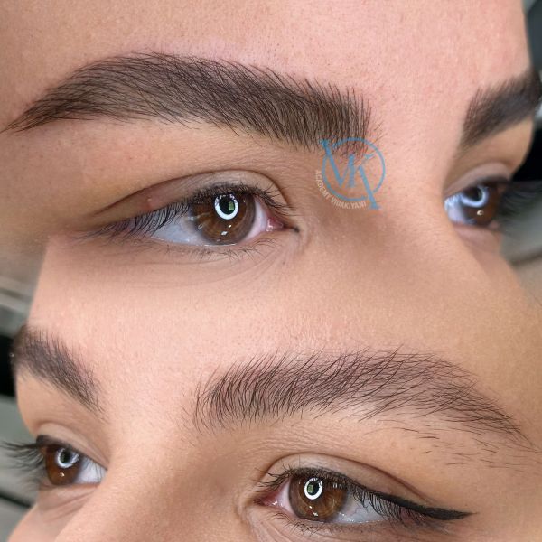 فیبروز ابرو