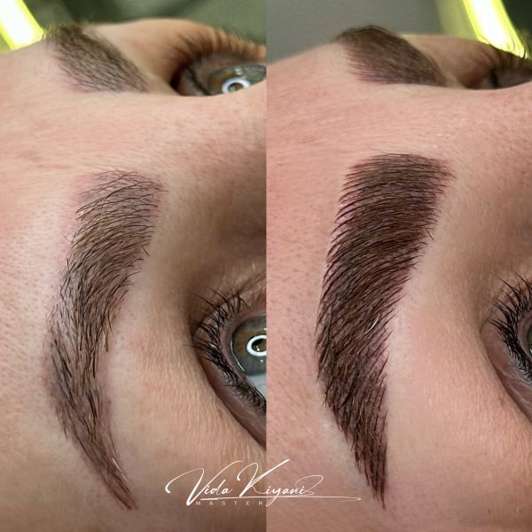 میکروبلیدینگ