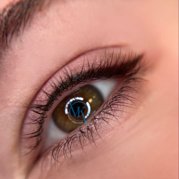 بن مژه طبیعی