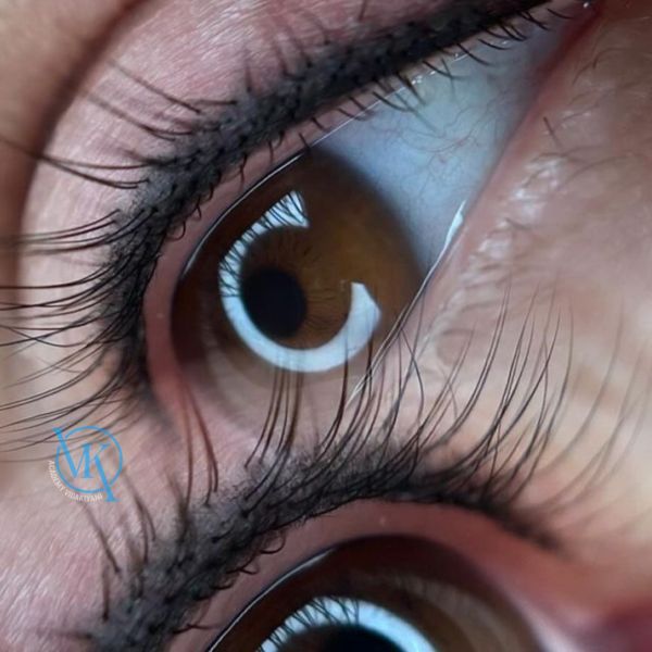 آیا بن مژه باعث ریزش مژه می شود؟