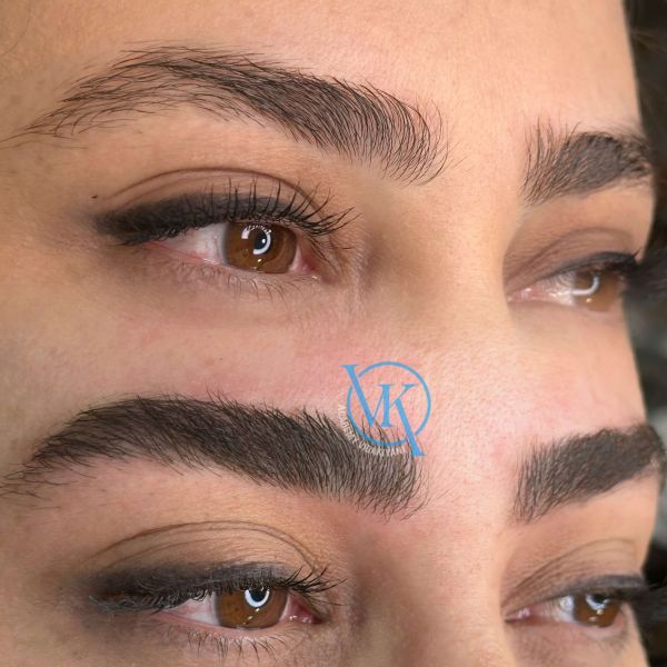 فیبروز نچرال