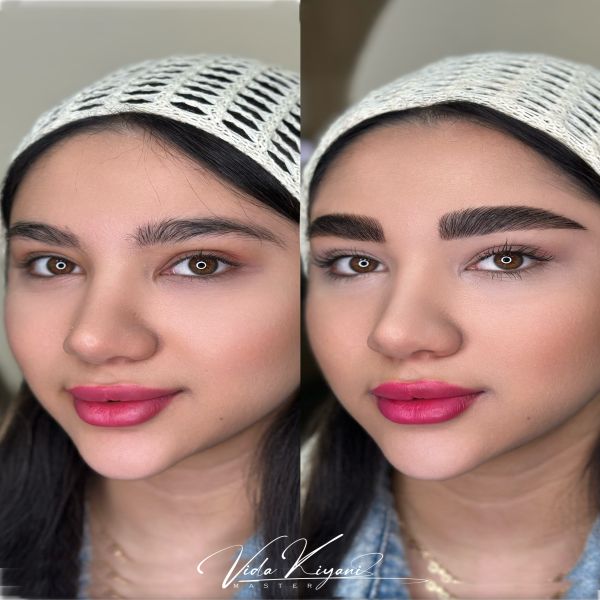 فیبروز نچرال دخترانه