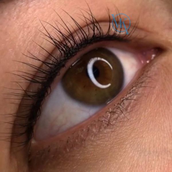 بن مژه طبیعی