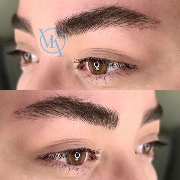 فیبروز ابرو