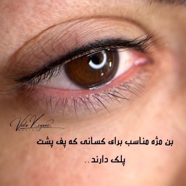 ماندگاری بن مژه