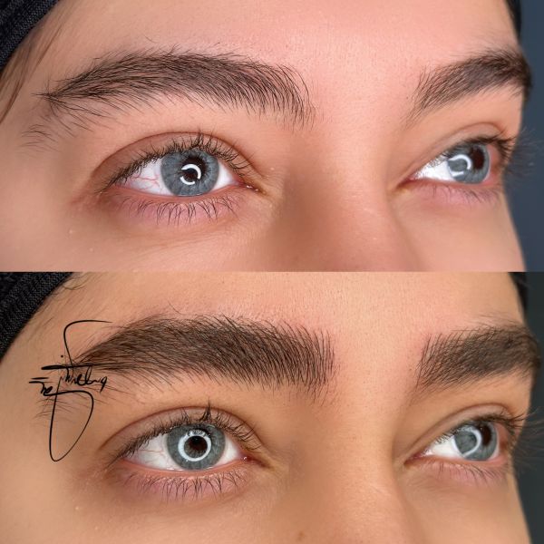 فیبروز ابرو