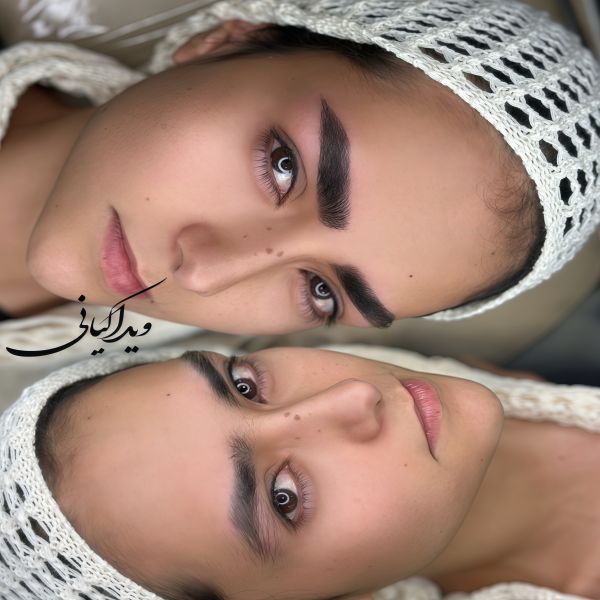 فیبروز تلفیقی ابرو