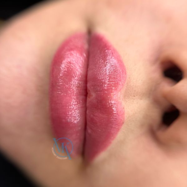 علت کبودی بعد از شیدینگ لب