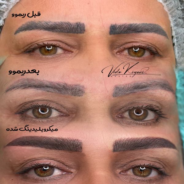 ریمو ابرو