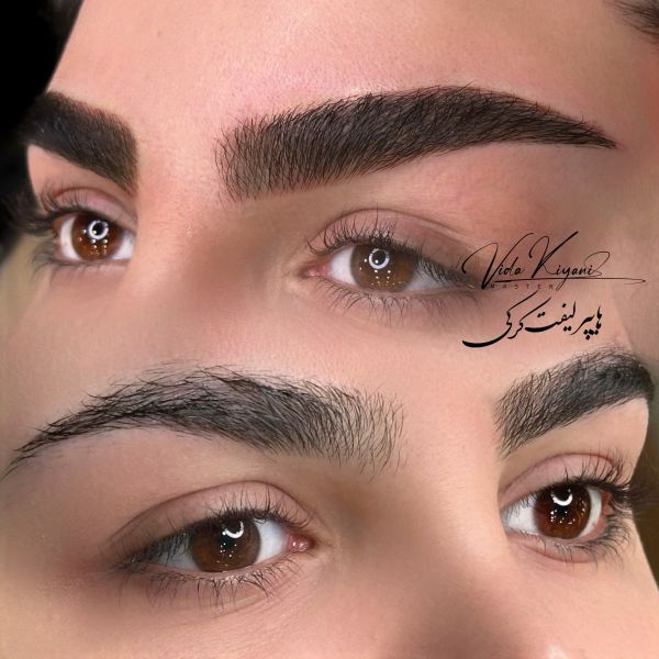 فیبروز ابرو