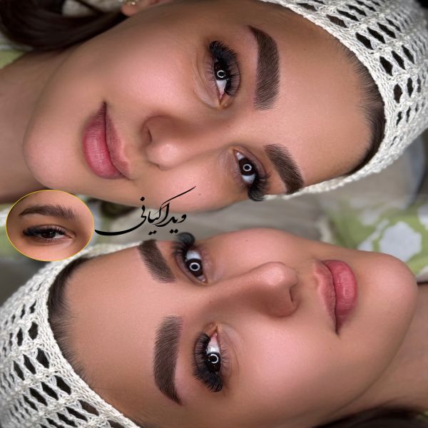 آیا فیبروز ابرو درد دارد؟