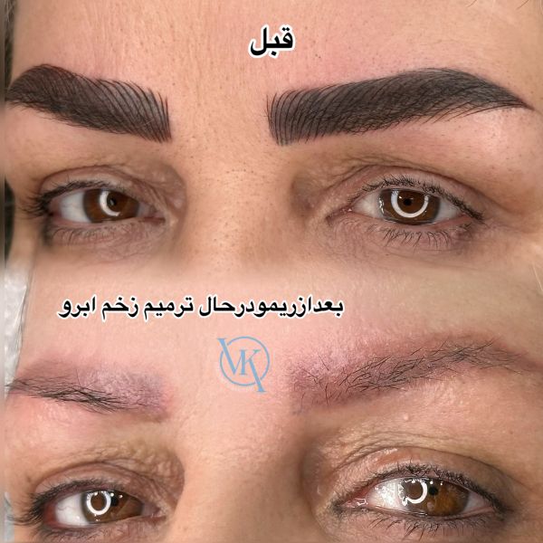 ریمو ابرو