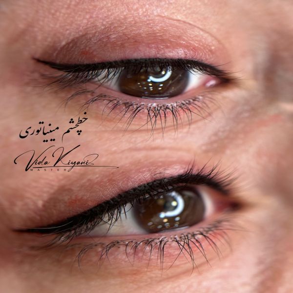 بن مژه