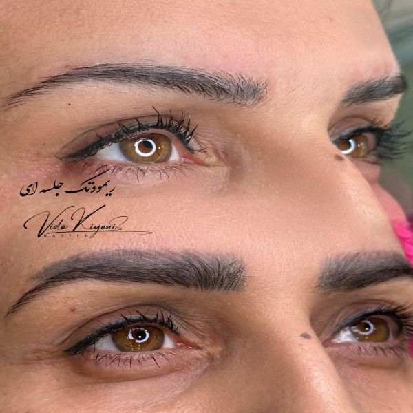 چگونه از تغییر رنگ فیبروز جلوگیری کنیم